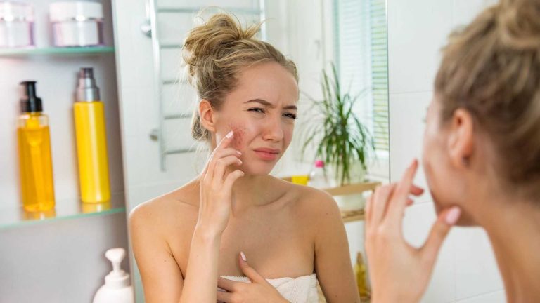 Relieve red skin with these tips from a celebrity esthetician